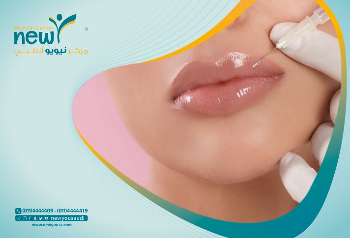 افضل دكتور فيلر شفايف بالرياض | مركز نيويو الطبي