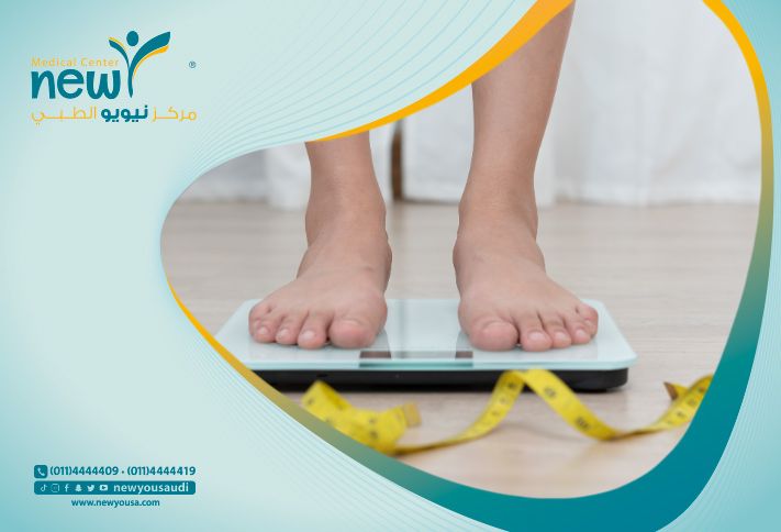 مميزات وعيوب عملية تكميم المعدة: كل ما تحتاج معرفته