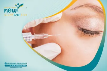علاج انتفاخ العين بعد البوتكس