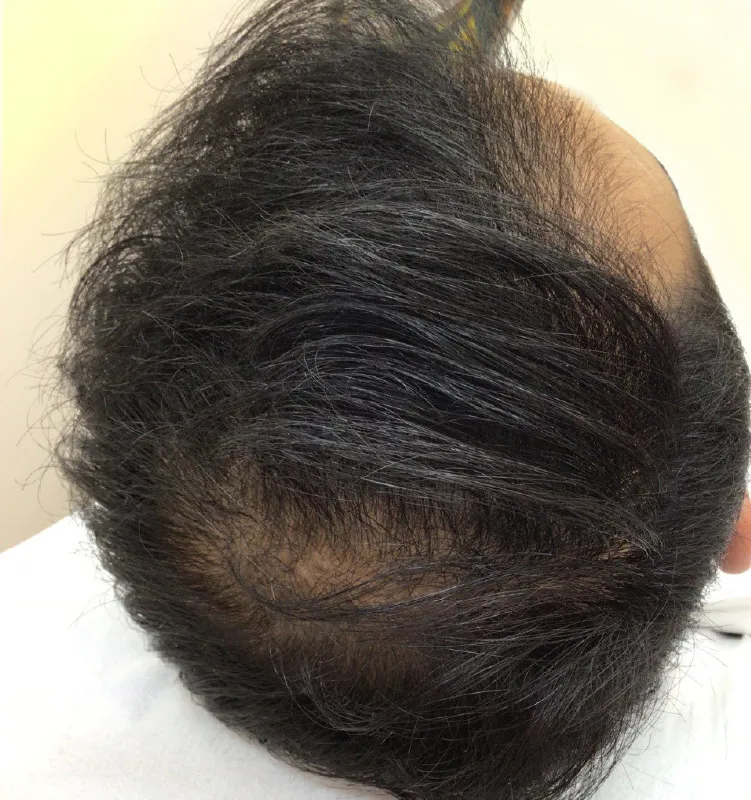 After - الجلدية